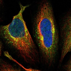 AFTPH Antibody, Novus Biologicals 0.1mL; Unlabeled:Antibodies, Polyclonal